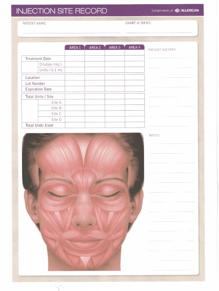 Fillable Online Botox Face Diagram Pdf Fax Email Print PdfFiller