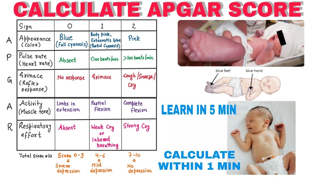 How To Calculate APGAR Score Pediatrics YouTube
