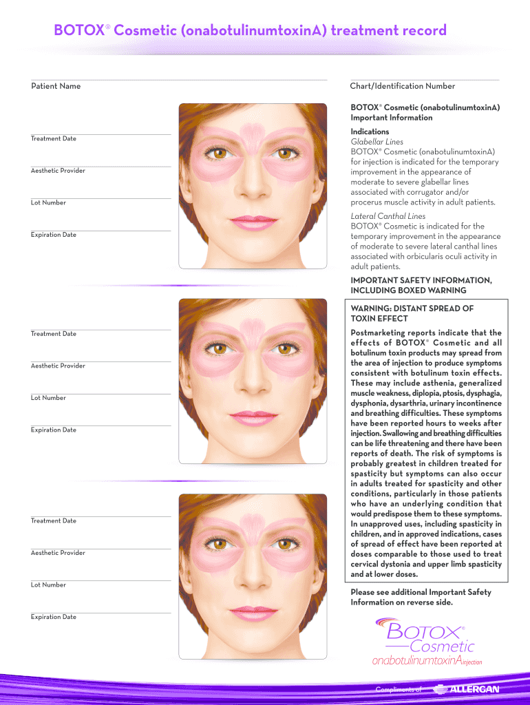 free printable botox face chart